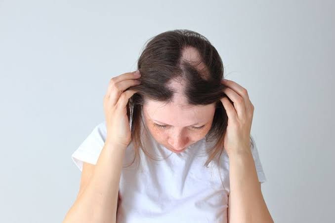 Penyebab Rambut Rontok Dan Cara Mengatasinya